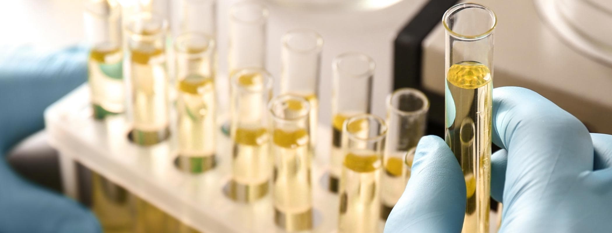 Laboratorijska analiza urina