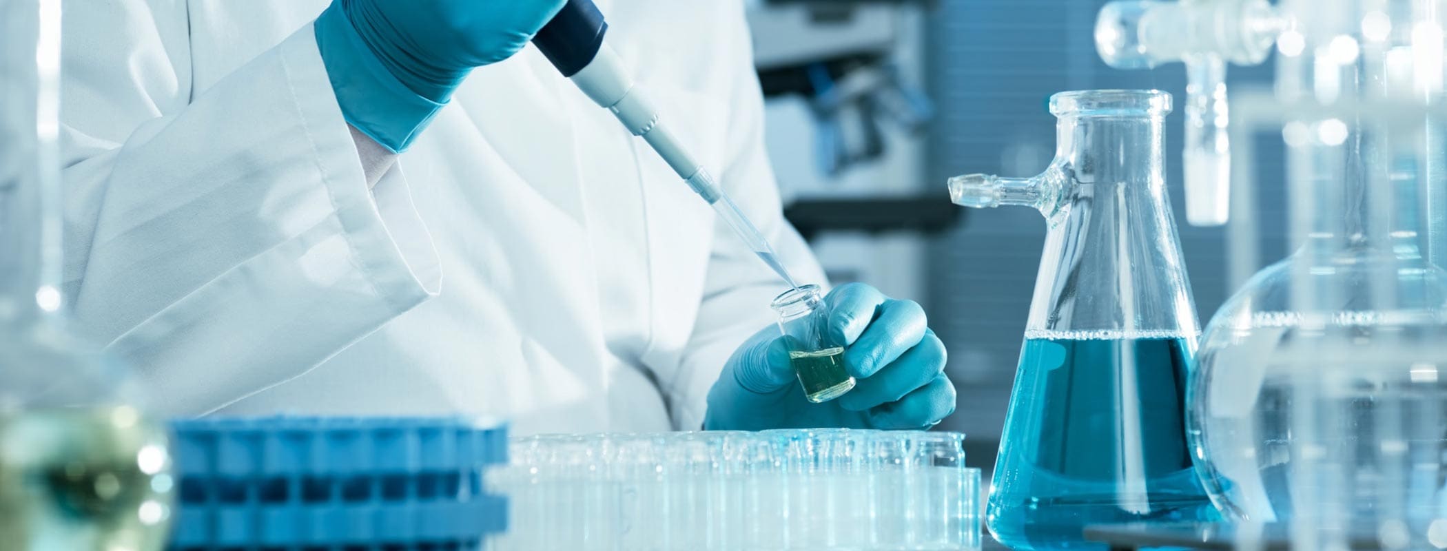 Laboratorijska analiza urina